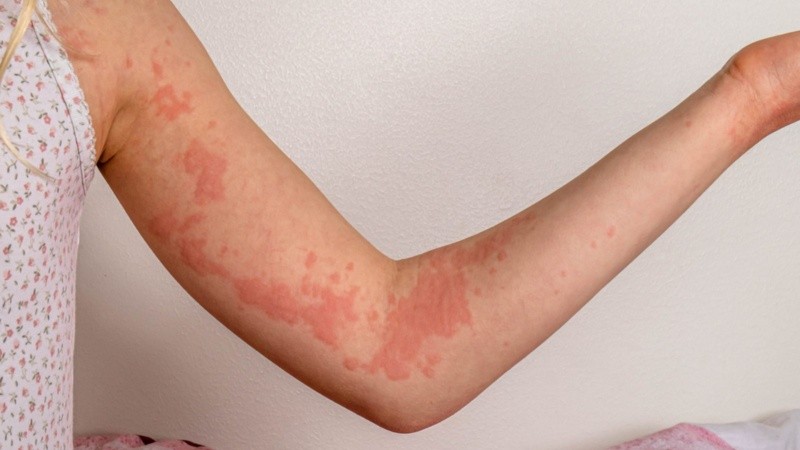 Es clave que médicos y pacientes trabajen en conjunto para determinar el mejor enfoque adaptado a cada caso.