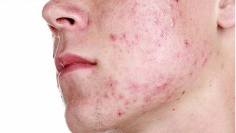 Acceder a este tipo de hallazgos permite salvar y/o mejorar miles de vidas.