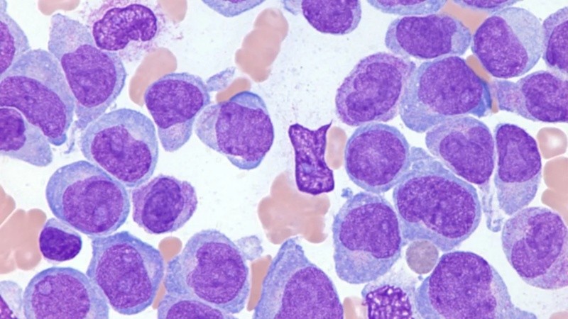 El objetivo es lograr una remisión completa y que la misma se sostenga en el tiempo.