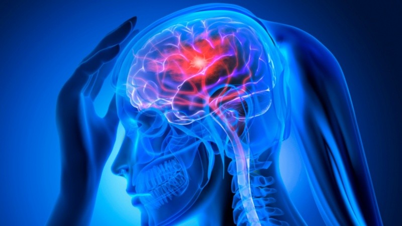 Se trata de un trastorno brusco de la circulación cerebral que altera la función de una determinada región del cerebro.