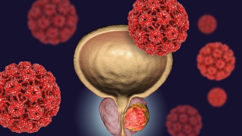 A partir de los 50 años se debe hacer un control preventivo anual y, en pacientes con antecedentes familiares, a partir de los 45 años.