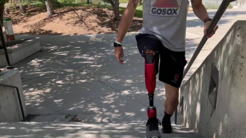 La estrategia implica recubrir con un fármaco antiinflamatorio los electrodos neurales que conectan la prótesis con el sistema nervioso.