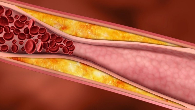 Es fundamental mantener una dieta saludable ya que la misma influye directamente en la formación de la microbiota intestinal.