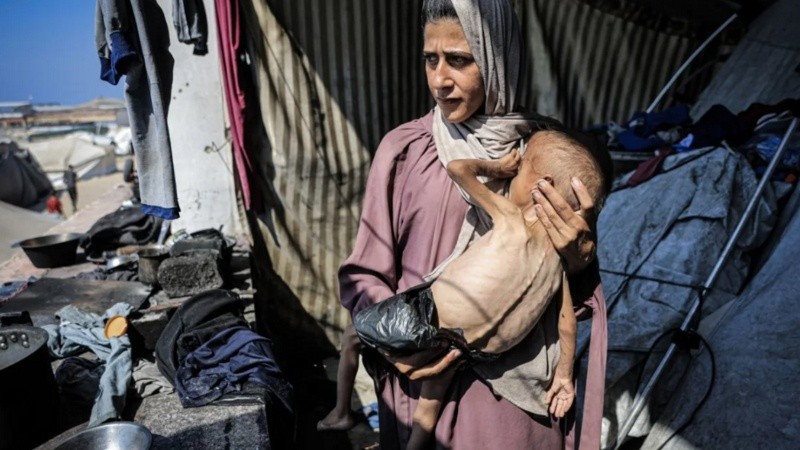 Muhammad Zakariya Ayyoub al-Matouq, de un año, se enfrenta a una desnutrición potencialmente mortal mientras la situación humanitaria empeora en Gaza. (EFE).