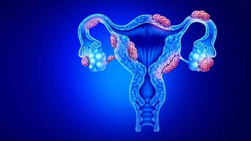 En el estudio, un 58% de pacientes con esta patología han conseguido quedarse embarazadas.