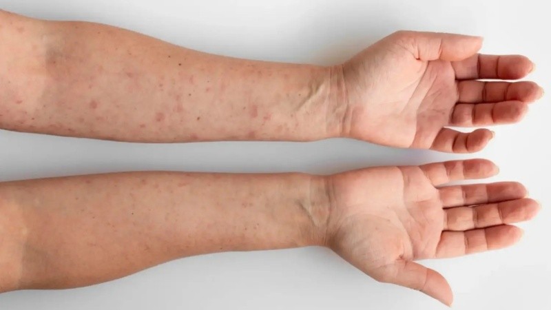 Esto se combina con prácticas sexuales 