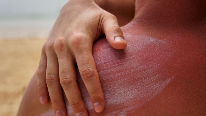 Según el SMN, gran parte del país estuvo la semana pasada bajo niveles de UV Muy Altos a Extremos.