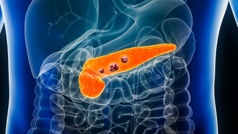 Tras eliminar genéticamente tres moléculas de la vía de señalización del gen mutado KRAS en modelos de ratón, los tumores desaparecieron de manera permanente.