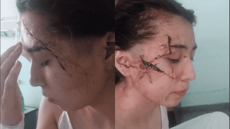 Delfina soportó tres operaciones estéticas, pero el asedio continúa, denunció su mamá.