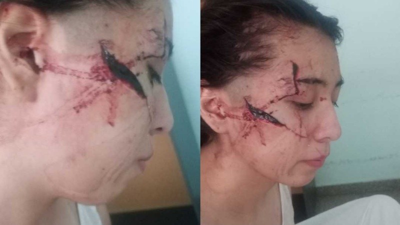 Las imágenes de Delfina con la cara desfigurada. El caso tiene cinco adolescentes involucrados en la agresión.