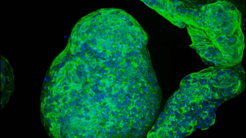 Por la electrónica implantada, los investigadores pudieron observar estos cambios y, además, estimular las células para potenciar su capacidad de respuesta ante el azúcar en sangre.