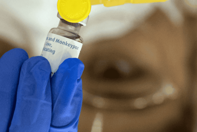 Primer caso de la variante más severa de Mpox en Argentina.&nbsp;