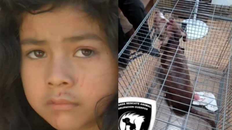 La nena atacada y el perro.