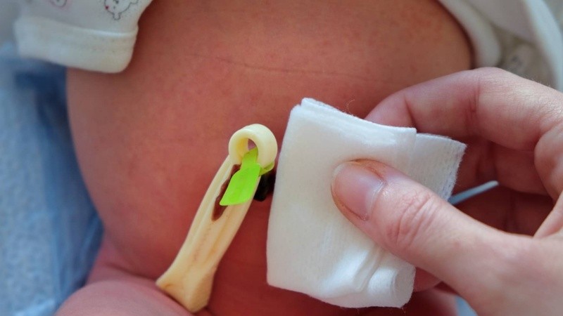 El cuidado del cordón en seco sigue siendo la técnica recomendada en los países con atención obstétrica adecuada y mortalidad neonatal baja pero, en muchos contextos, las técnicas antisépticas podrían reducir riesgos de infección.