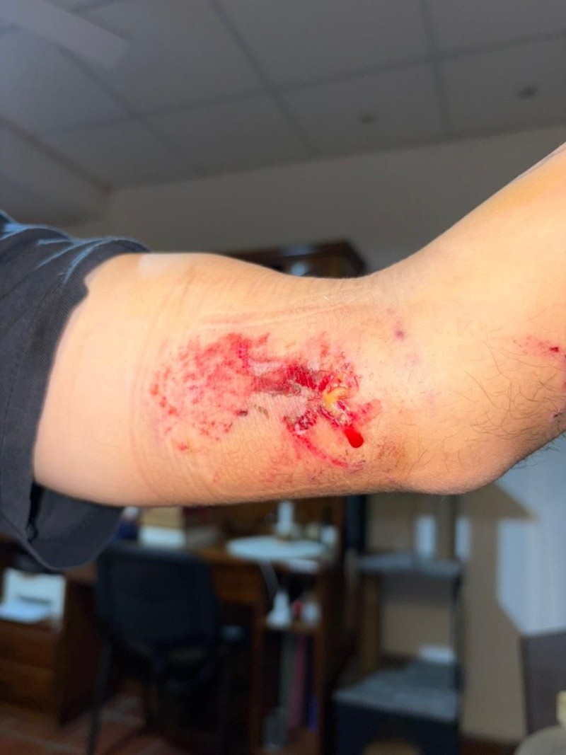 &nbsp;Huellas del ataque de los perros.