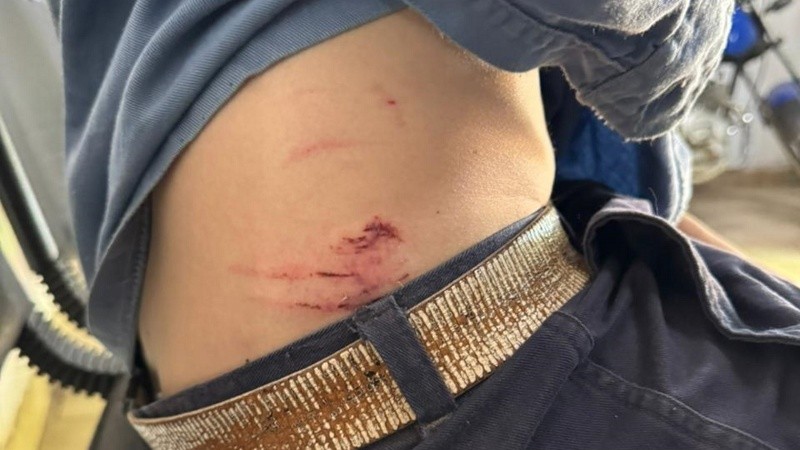 El operario hacía tareas de medición cuando fue atacado por los perros.