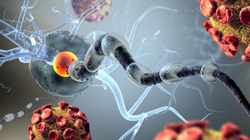 La esclerosis múltiple es una enfermedad neurodegenerativa, autoinmune y crónica que impacta especialmente en adultos jóvenes.