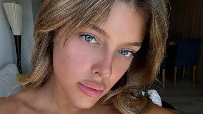 La influencer habló de las cirugías estéticas