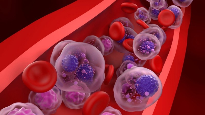 Los investigadores descubrieron el papel del factor de transcripción IRF2 en el desarrollo de este tipo de cáncer.