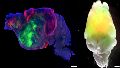 Neuronas humanas, cerebro de ratón: el sorprendente experimento que abre una nueva frontera en neurociencia