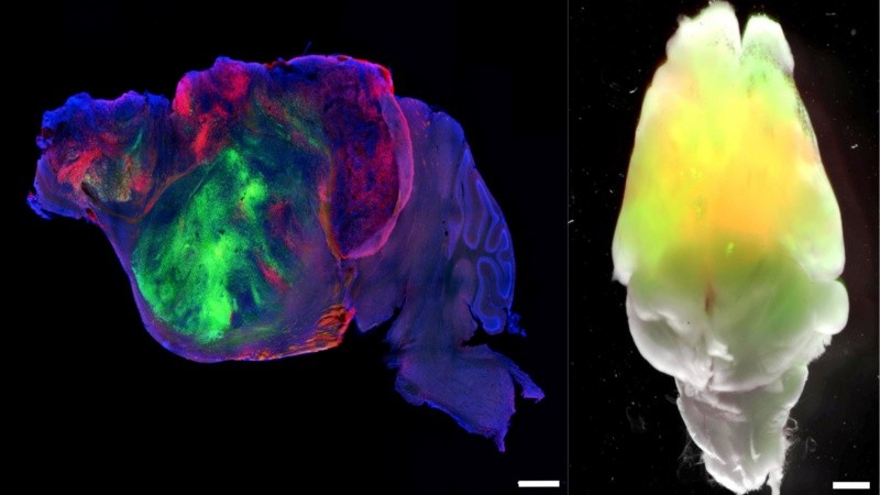 Vistas lateral y superior del cerebro de un ratón xecortical. Fibras nerviosas del injerto humano en rojo y verde. Barra de escala: 1 mm (izq.) y 2 mm (der.) (Foto: S. Pasca lab, Stanford University)  
