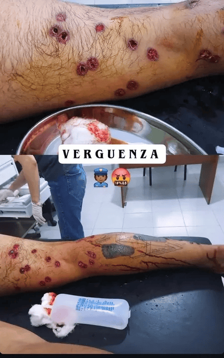 La imagen que subió uno de los heridos a sus redes. (Casilda Plus) 