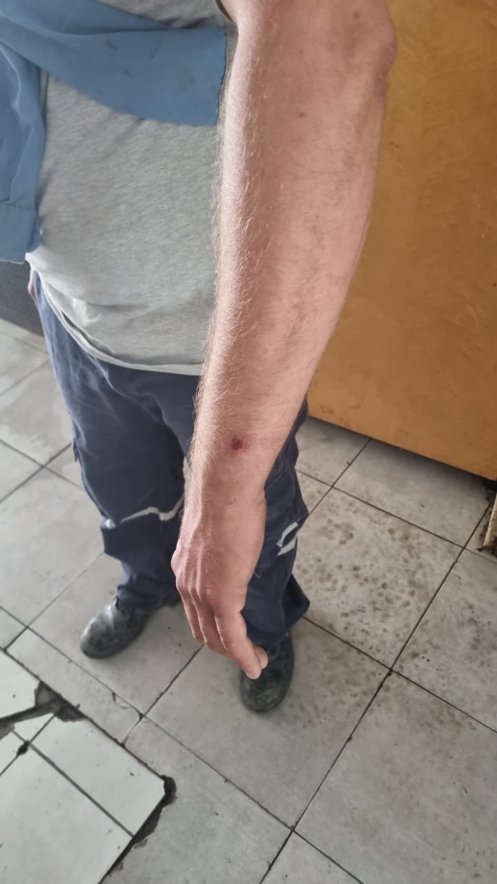 &nbsp;Uno de los operarios sufrió lesiones en una de sus muñecas.