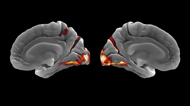 &nbsp;Patrón de activación cerebral ante estímulos visuales, medido con fMRI y modelado por IA